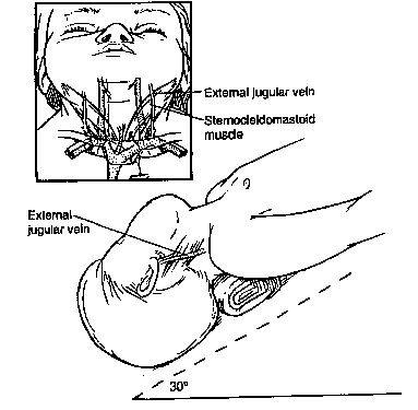 VEIAS JUGULARES